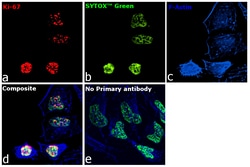 Invitrogen Ki-67 Recombinant Rat Monoclonal Antibody (SolA15), Invitrogen