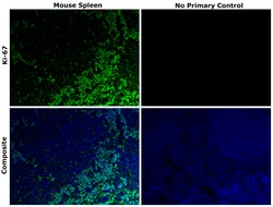 Invitrogen Ki-67 Recombinant Rat Monoclonal Antibody (SolA15), Invitrogen