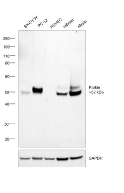 Invitrogen Parkin Recombinant Rabbit Monoclonal Antibody (21H24L9), Invitrogen