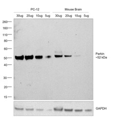 Invitrogen Parkin Recombinant Rabbit Monoclonal Antibody (21H24L9), Invitrogen