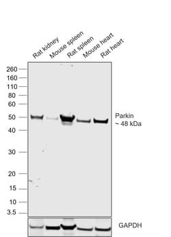 Invitrogen Parkin Recombinant Rabbit Monoclonal Antibody (21H24L9), Invitrogen