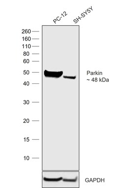 Invitrogen Parkin Recombinant Rabbit Monoclonal Antibody (21H24L9), Invitrogen