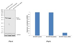 Parkin Recombinant Rabbit Monoclonal Antibody (21H24L9), Invitrogen:Antibodies:Primary