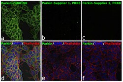 Invitrogen Parkin Recombinant Rabbit Monoclonal Antibody (21H24L9), Invitrogen 40 &mu;L | Buy Online | Invitrogen&trade; | Fisher Scientific