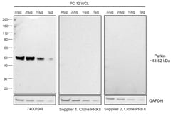 Invitrogen Parkin Recombinant Rabbit Monoclonal Antibody (21H24L9), Invitrogen 40 &mu;L | Buy Online | Invitrogen&trade; | Fisher Scientific