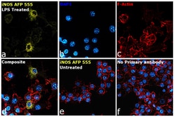 Invitrogen iNOS Recombinant Rat Monoclonal Antibody (CXNFT), Alexa Fluor Plus 555, Invitrogen 50 &mu;L | Buy Online | Invitrogen&trade; | Fisher Scientific