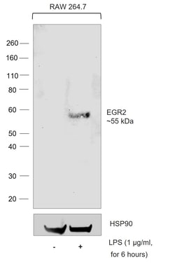 Invitrogen EGR2 Recombinant Rat Monoclonal Antibody (erongr2):Antibodies:Primary