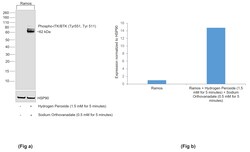 Invitrogen Phospho-BTK/ITK (Tyr551, Tyr511) Monoclonal Antibody (M4G3LN):Antibodies:Primary