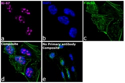 Invitrogen&trade;&nbsp;Ki-67 Recombinant Mouse Monoclonal Antibody (20raj1)