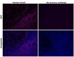 Invitrogen CD4 Recombinant Mouse Monoclonal Antibody (N1UG0) 100 &mu;L | Buy Online | Invitrogen&trade; | Fisher Scientific