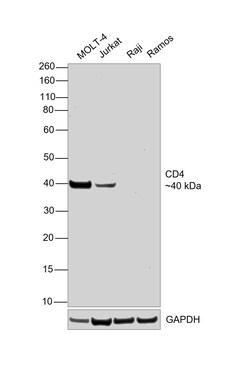 Invitrogen CD4 Recombinant Mouse Monoclonal Antibody (N1UG0) 100 &mu;L | Buy Online | Invitrogen&trade; | Fisher Scientific