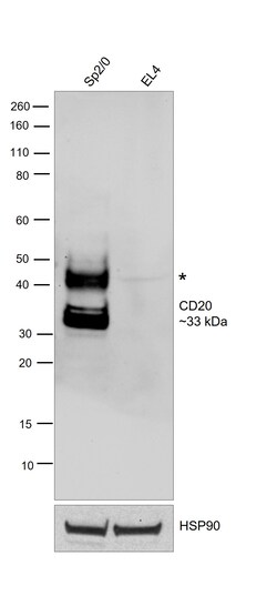 Invitrogen&trade;&nbsp;CD20 Recombinant Rat Monoclonal Antibody (AISB12)