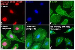 Invitrogen Phospho-CHK2 (Thr68) Recombinant Mouse Monoclonal Antibody (ebchk2), Alexa Fluor Plus 647 50 &mu;L | Buy Online | Invitrogen&trade; | Fisher Scientific