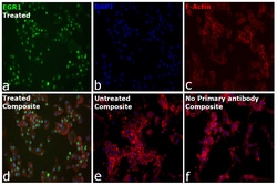 Invitrogen EGR1 Recombinant Rat Monoclonal Antibody (HEGR1DS) 100 &mu;L | Buy Online | Invitrogen&trade; | Fisher Scientific
