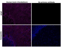 Invitrogen GFAP Recombinant Mouse Monoclonal Antibody (GA5) 100 &mu;L | Buy Online | Invitrogen&trade; | Fisher Scientific