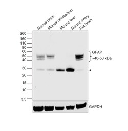 Invitrogen GFAP Recombinant Mouse Monoclonal Antibody (GA5) 100 &mu;L | Buy Online | Invitrogen&trade; | Fisher Scientific