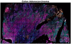 Invitrogen&trade;&nbsp;CD68 Monoclonal Antibody (KP1), Alexa Fluor&trade; Plus 488