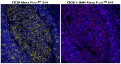 Invitrogen&trade;&nbsp;CD20 Monoclonal Antibody (L26), Alexa Fluor&trade; 514