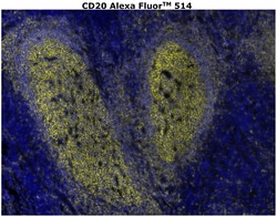 Invitrogen CD20 Monoclonal Antibody (L26), Alexa Fluor 514 500 &mu;L | Buy Online | Invitrogen&trade; | Fisher Scientific