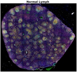 Invitrogen&trade;&nbsp;Ki-67 Monoclonal Antibody (SolA15), Alexa Fluor&trade; 514