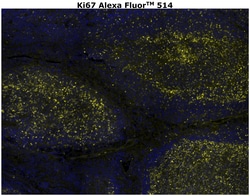 Ki-67 Monoclonal Antibody (SolA15), Alexa Fluor™ 514, Invitrogen™