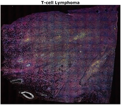 Invitrogen&trade;&nbsp;Ki-67 Monoclonal Antibody (SolA15), Alexa Fluor&trade; 514