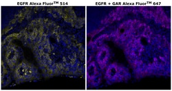 Invitrogen&trade;&nbsp;EGFR Recombinant Rabbit Monoclonal Antibody (30H45L48), Alexa Fluor&trade; 514