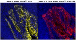 Invitrogen™ Pan Cytokeratin Monoclonal Antibody (AE1/AE3), Alexa Fluor™ 514