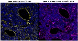 Invitrogen Alpha-Smooth Muscle Actin Monoclonal Antibody (1A4), Alexa Fluor