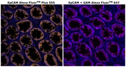 Invitrogen CD326 (EpCAM) Monoclonal Antibody (VU-1D9), Alexa Fluor Plus 555 500 &mu;L | Buy Online | Invitrogen&trade; | Fisher Scientific