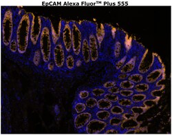 Invitrogen CD326 (EpCAM) Monoclonal Antibody (VU-1D9), Alexa Fluor Plus 555 500 &mu;L | Buy Online | Invitrogen&trade; | Fisher Scientific