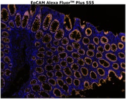 Invitrogen CD326 (EpCAM) Monoclonal Antibody (VU-1D9), Alexa Fluor Plus 555 500 &mu;L | Buy Online | Invitrogen&trade; | Fisher Scientific
