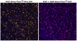 Ki-67 Monoclonal Antibody (SolA15), Alexa Fluor&trade; Plus 555, Invitrogen&trade;