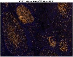 Ki-67 Monoclonal Antibody (SolA15), Alexa Fluor™ Plus 555, Invitrogen™