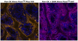 Invitrogen™ Cytokeratin Pan Type I/II Monoclonal Antibody (AE1/AE3), Alexa Fluor™ Plus 555