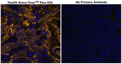 Invitrogen&trade;&nbsp;Cytokeratin Pan Type I/II Antibody Cocktail, Alexa Fluor&trade; Plus 555