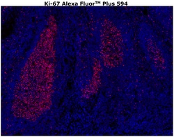 Invitrogen Ki-67 Monoclonal Antibody (SolA15), Alexa Fluor Plus 594 500