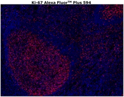 Invitrogen Ki-67 Monoclonal Antibody (SolA15), Alexa Fluor Plus 594 500