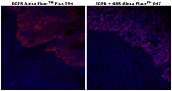 Invitrogen&trade;&nbsp;EGFR Recombinant Rabbit Monoclonal Antibody (30H45L48), Alexa Fluor&trade; Plus 594