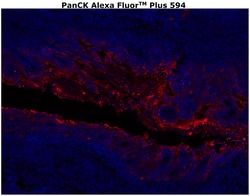 Cytokeratin Pan Type I/II Antibody Cocktail, Alexa Fluor™ Plus 594, Invitrogen™