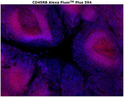 Invitrogen CD45RB Monoclonal Antibody (PD7/26), Alexa Fluor Plus 594 100 &mu;g | Buy Online | Invitrogen&trade; | Fisher Scientific