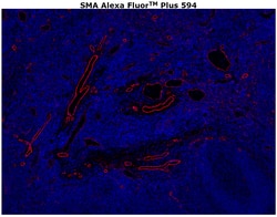 Invitrogen Alpha-Smooth Muscle Actin Monoclonal Antibody (1A4), Alexa Fluor Plus 594 100 &mu;g | Buy Online | Invitrogen&trade; | Fisher Scientific