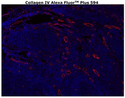 Collagen IV Monoclonal Antibody (1042), Alexa Fluor™ Plus 594, Invitrogen™
