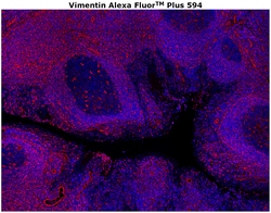 Invitrogen Vimentin Monoclonal Antibody (V9), Alexa Fluor Plus 594 100 &mu;g | Buy Online | Invitrogen&trade; | Fisher Scientific