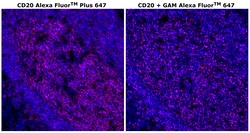 Invitrogen CD20 Monoclonal Antibody (L26), Alexa Fluor Plus 647 500 &mu;L;
