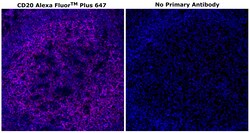 Invitrogen CD20 Monoclonal Antibody (L26), Alexa Fluor Plus 647 500 &mu;L;