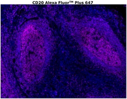 Invitrogen CD20 Monoclonal Antibody (L26), Alexa Fluor Plus 647 500 &mu;L;