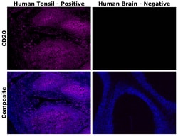 Invitrogen™ CD20 Monoclonal Antibody (L26), Alexa Fluor™ Plus 647