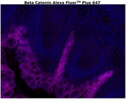 Invitrogen beta Catenin Monoclonal Antibody (15B8), Alexa Fluor Plus 647 500 &mu;L | Buy Online | Invitrogen&trade; | Fisher Scientific