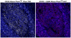 Invitrogen CD20 Monoclonal Antibody (L26), Alexa Fluor Plus 750 500 &mu;L;
